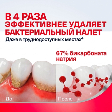 Купить Пародонтакс отбеливающая 75 мл паста зубная