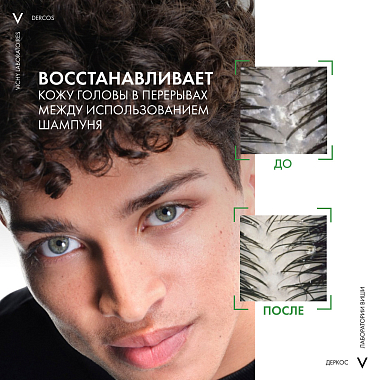 Купить Vichy Dercos Serum 10 90 мл сыворотка интенсивная для кожи головы против перхоти