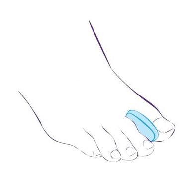 Купить Тривес приспособление ортопедическое силиконовое межпальцевые перегородки размер L Артикул СТ-32