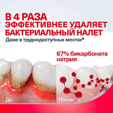 Купить Пародонтакс Комплексная защита Экстра свежесть 75 мл паста зубная