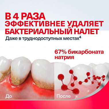 Купить Пародонтакс отбеливающая 75 мл паста зубная