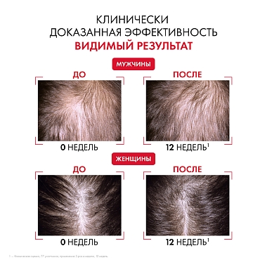 Купить Vichy Dercos Aminexil Regen Booster 90 мл сыворотка-спрей для укрепления и роста волос против выпадения и алопеции