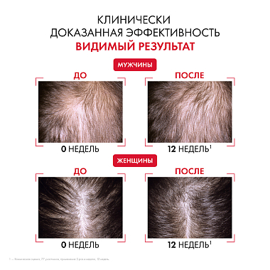 Купить Vichy Dercos Aminexil Regen Booster 90 мл сыворотка-спрей для укрепления и роста волос против выпадения и алопеции
